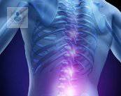 tumores-espinales imagen de artículo