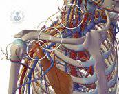 sindrome-del-operculo-toracico-un-padecimiento-que-si-tiene-cura-p1 imagen de artículo