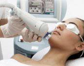 fotorejuvenecimiento-facial-ipl-luz-pulsada imagen de artículo