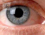 Cataracts: a simple cure that prevents blindness (P2)
