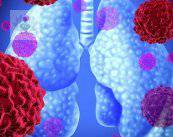 cancer-sintomatologia-a-grandes-rasgos-p2 imagen de artículo