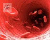carotida-obstruida-que-es-y-como-atenderla imagen de artículo