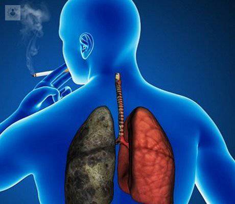 Cáncer de pulmón: causas y tipos (Parte 1)