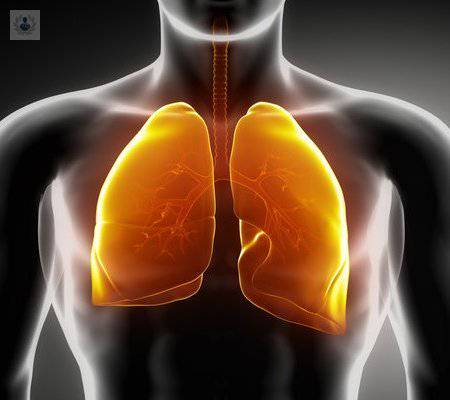 Cáncer de pulmón: factores de riesgo y opciones de tratamiento (Parte 2)