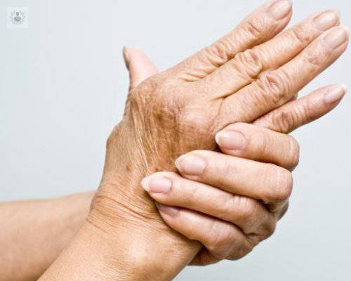 Artritis reumatoide: síntomas más comunes y opciones de tratamiento