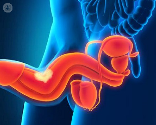 enfermedad-de-peyronie-curvatura-del-pene-de-origen-desconocido imagen de artículo