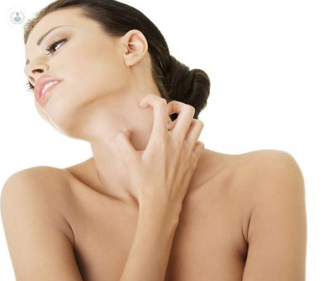 dermatitis-atopica-inflamacion-cronica-de-la-piel imagen de artículo