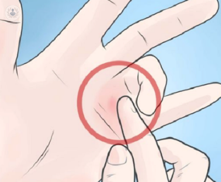 dedo-en-gatillo-en-que-consiste-el-tratamiento imagen de artículo