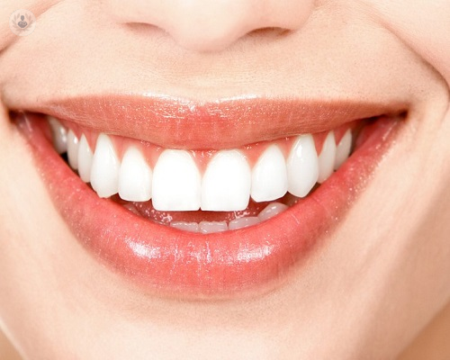 Carillas dentales - Vuelve a Sonreír con confianza – CLINY FARMY