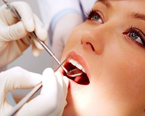 Periodontitis y gingivitis: estudio de los tejidos del soporte de los dientes