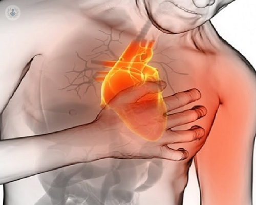 sintomas-de-infarto-y-dolor-de-pecho-parte-1 imagen de artículo