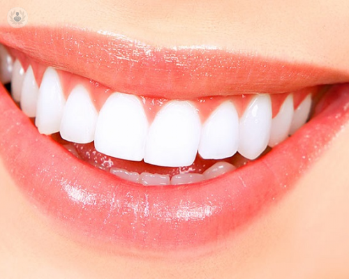 Estética dental: ¿por qué es tan importante? (Parte 1)