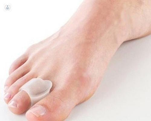 cirugia-ortopedica-de-minima-invasion-que-padecimientos-se-pueden-atender imagen de artículo