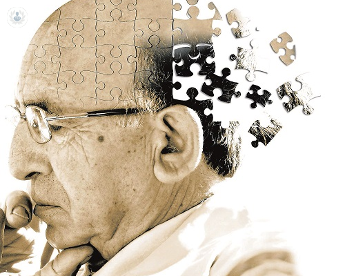 Alzheimer: síntomas y causas (Parte 1)