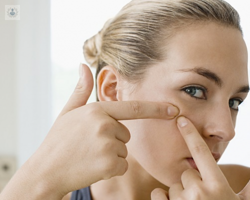 acne-que-pasa-si-nunca-voy-con-el-dermatologo imagen de artículo