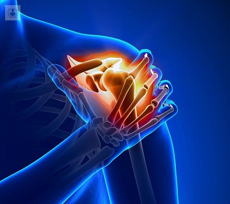 protesis-de-hombro-que-son-y-como-es-el-proceso-de-implantacion-p2 imagen de artículo