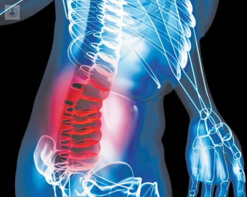 que-sucede-si-tengo-mieloma-multiple imagen de artículo