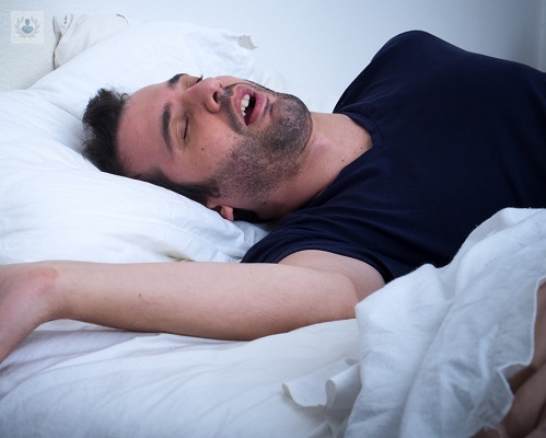 tratamiento-para-la-apnea-cual-es-el-mejor-p2 imagen de artículo