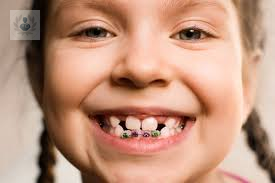 Aprende más de la ortodoncia en niños