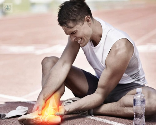 prevencion-de-lesiones-deportivas imagen de artículo