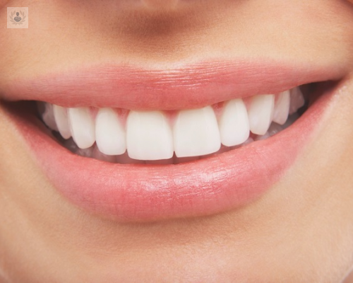 importancia-de-la-estetica-dental-en-mexico imagen de artículo