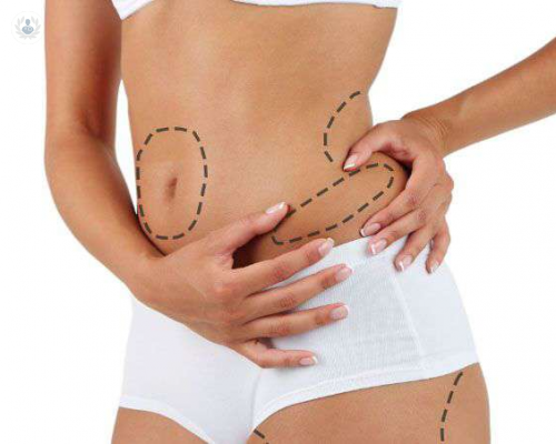 el-cuerpo-ideal-a-traves-de-la-cirugia-estetica imagen de artículo