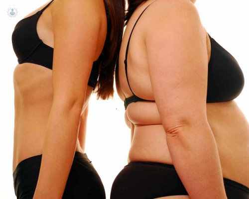 cual-es-el-objetivo-de-la-cirugia-posbariatrica imagen de artículo