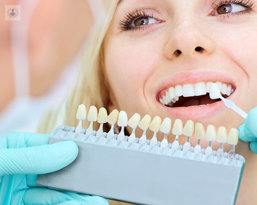 de-que-estan-hechos-los-implantes-dentales-y-como-se-colocan imagen de artículo