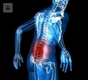 fracturas-de-vertebras-que-son-causas-y-tratamientos imagen de artículo