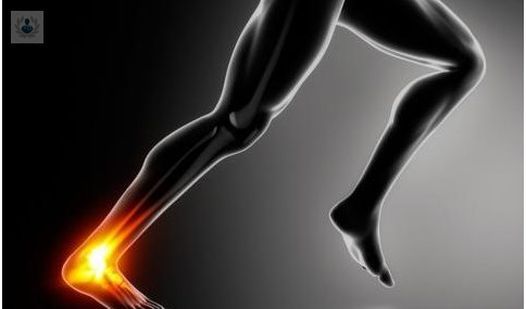 tendon-de-aquiles-que-es-y-cual-es-su-tratamiento imagen de artículo