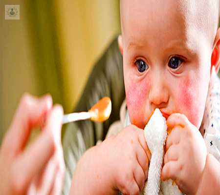 Alergias en niños ¿Cuáles son las más comunes y cómo detectarlas?