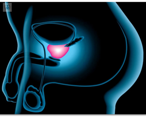Enfermedades comunes de la próstata: lo que todo hombre debe saber