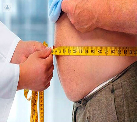 la-obesidad-un-enemigo-para-tu-higado imagen de artículo
