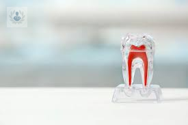 ¿Por qué se daña la Pulpa Dental?