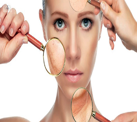 Lo que debes saber sobre el rejuvenecimiento facial