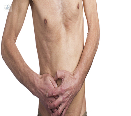 lo-que-no-sabias-de-las-hernias-inguinales imagen de artículo