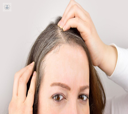¿Cómo combatir la alopecia? ¡Te lo decimos! 