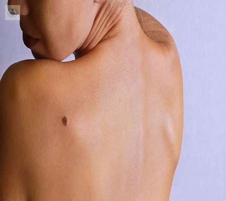 aprendiendo-a-cuidar-la-piel-del-sol imagen de artículo