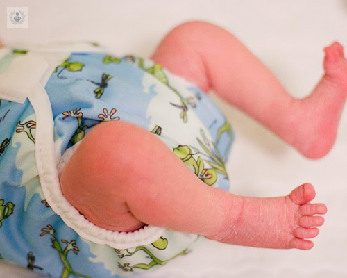 como-tratar-la-dermatitis-del-panal imagen de artículo