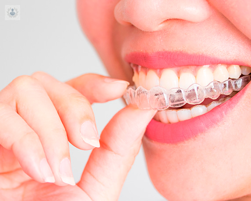 Ortodoncia Preventiva ¿Cuándo y cómo se hace? 
