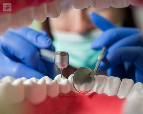 Endodoncia: tratamiento ideal para salvar tus dientes