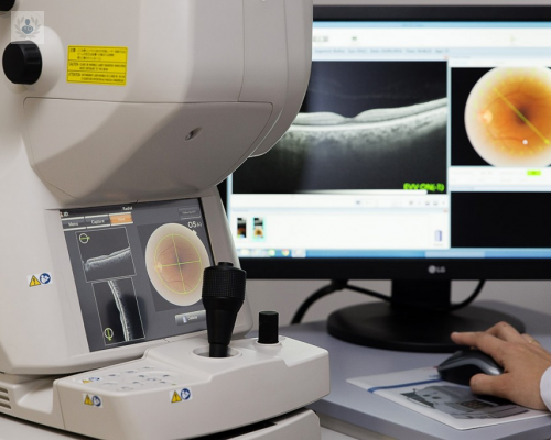 tomografia-de-coherencia-optica-imagenes-bidimensionales-claras imagen de artículo