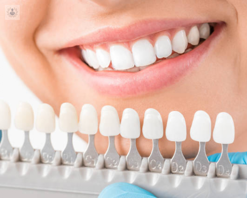 Coronas Dentales, solución para un diente dañado