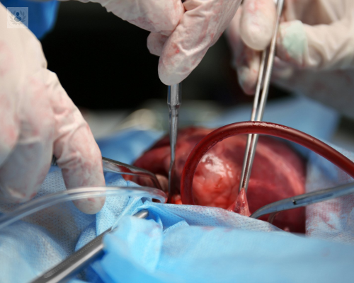 Lo que no sabías del trasplante renal
