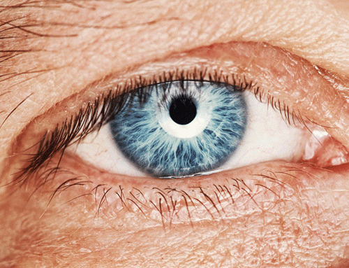 Lo que no sabías sobre los tumores oculares