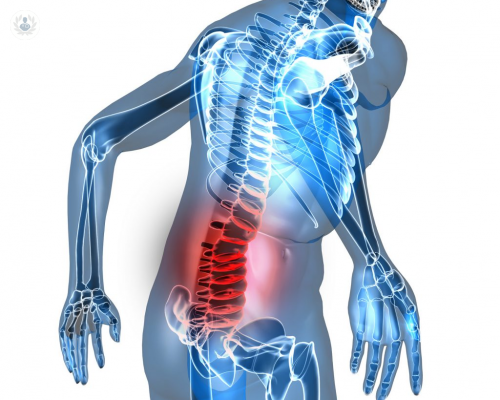 artrosis-vertebral-un-problema-principal-de-la-edad imagen de artículo