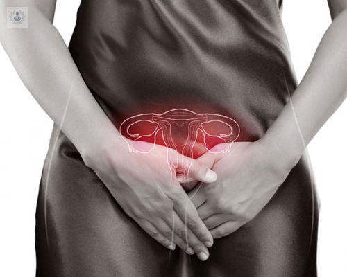 sindrome-de-ovarios-poliquisticos-la-causa-mas-comun-de-infertilidad imagen de artículo