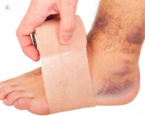 pie-diabetico-un-problema-de-prevencion-y-tratamiento-tardio imagen de artículo