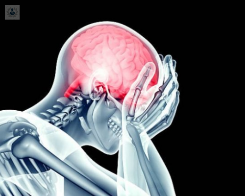 infarto-cerebral-un-problema-de-colesterol-y-trigliceridos imagen de artículo