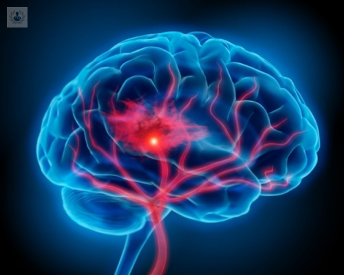 Daño Neurológico: ¿Cuáles son los factores de riesgo?